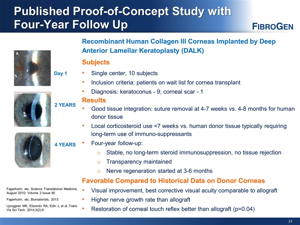 Slide 31