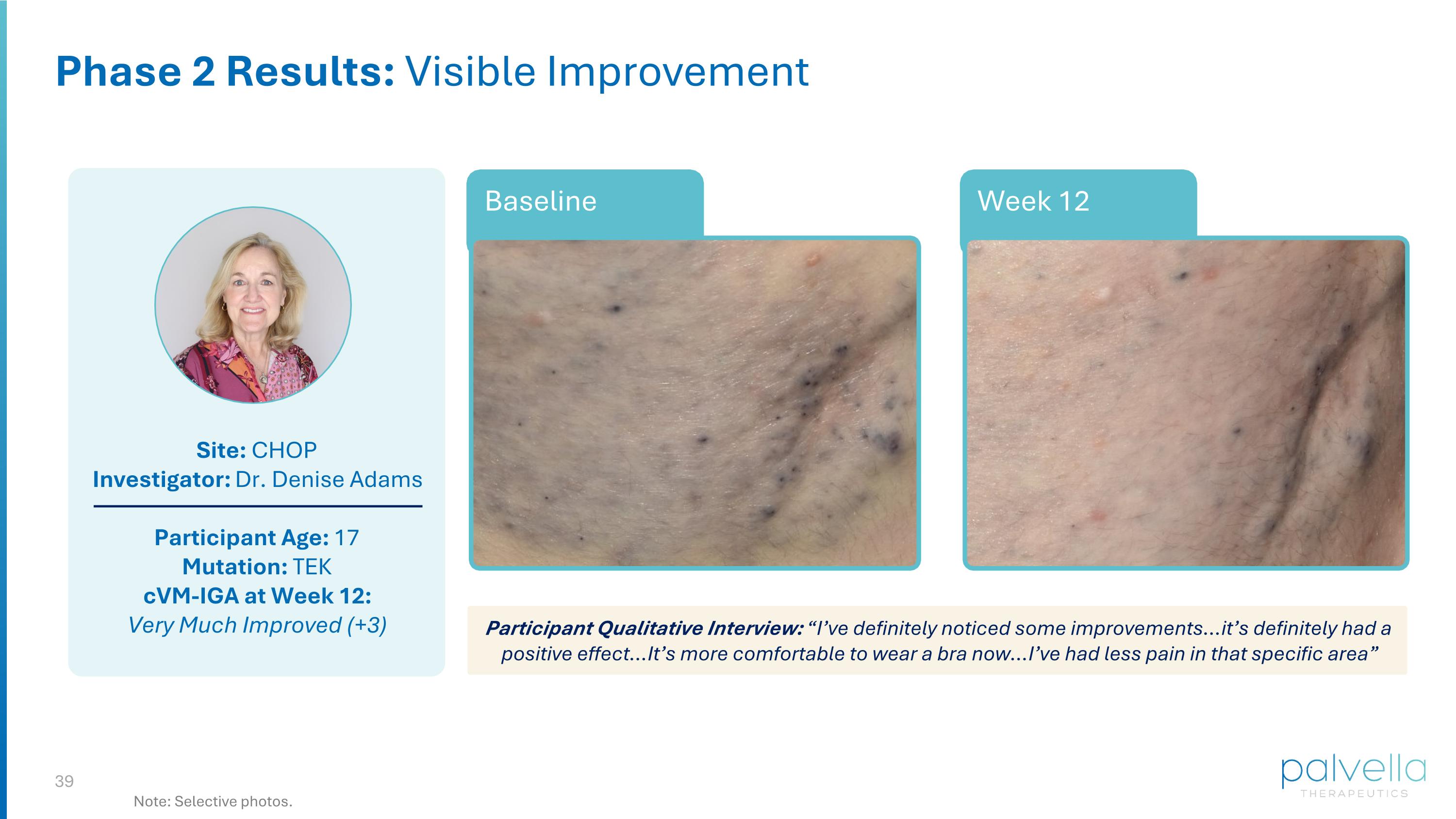 Slide 39
