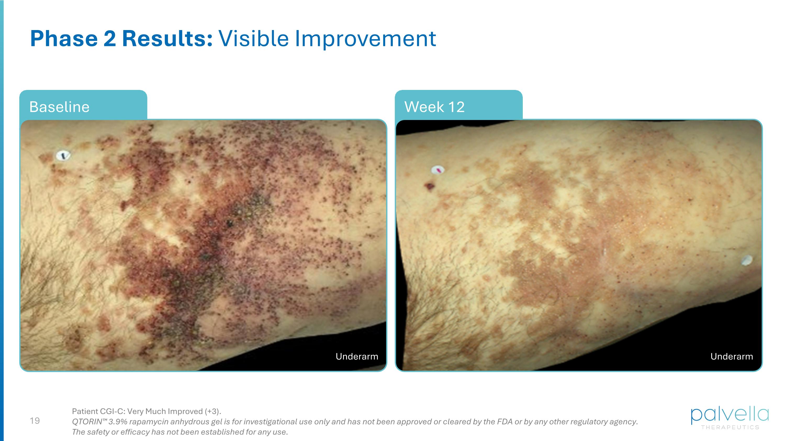 Slide 19
