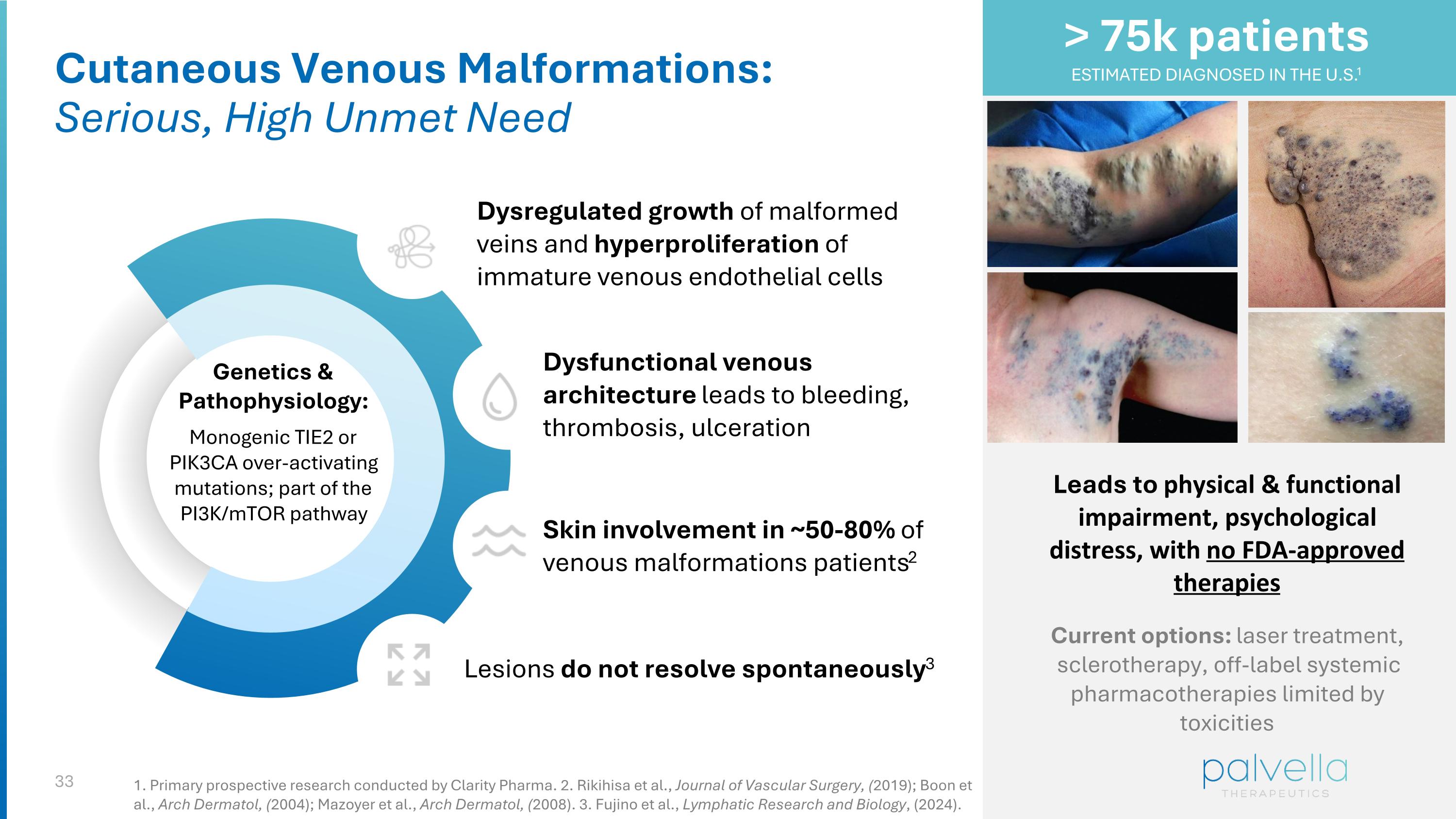 Slide 33