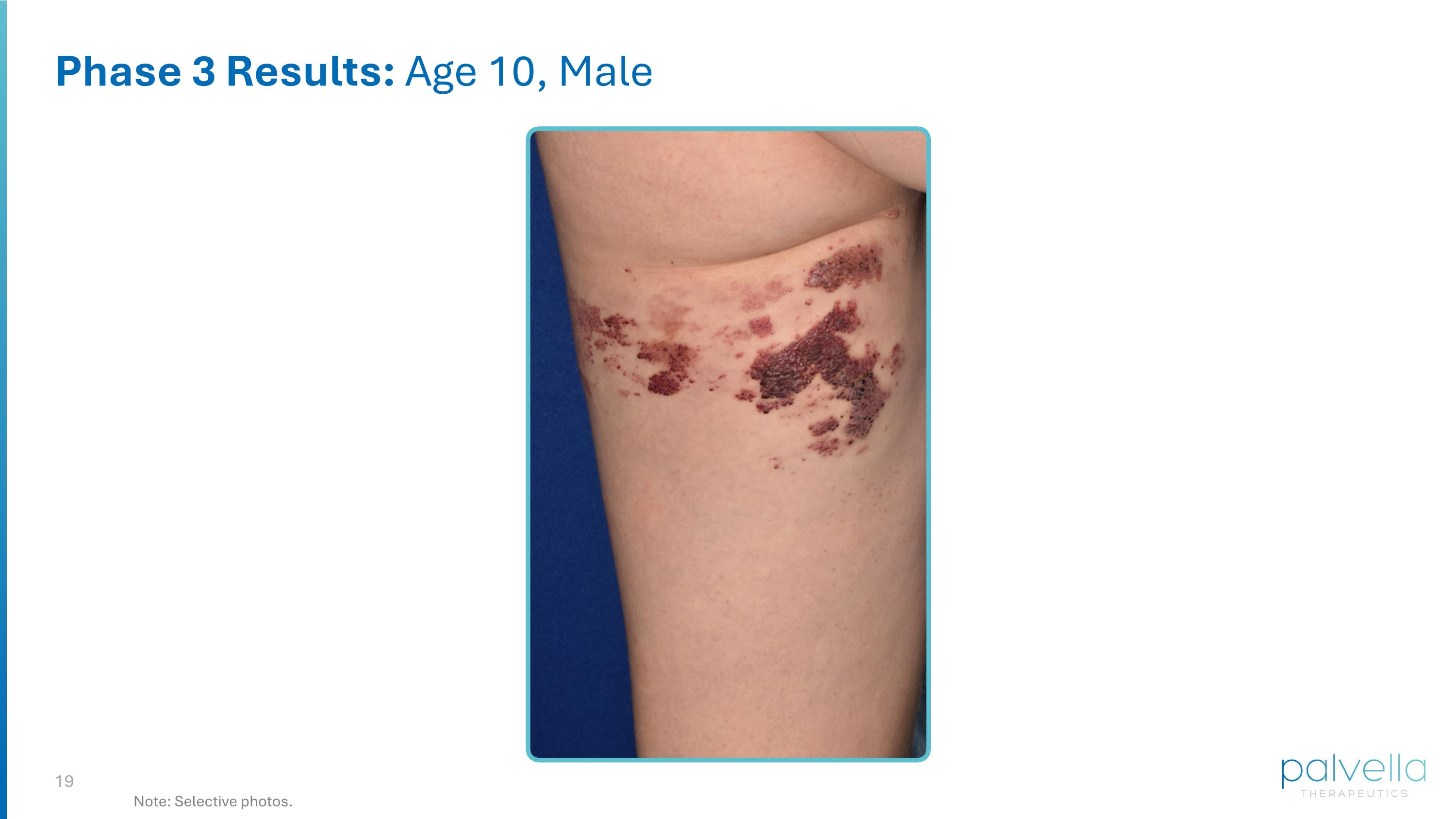 Slide 19